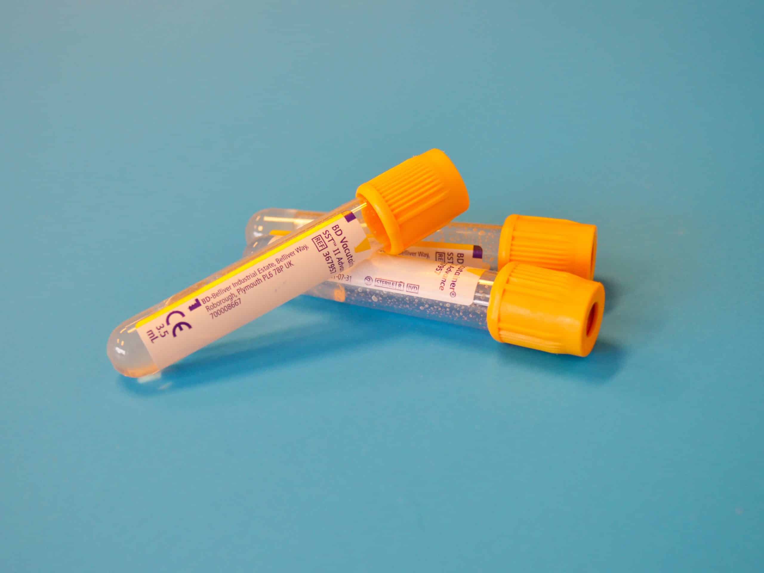 Tube-laboratoire