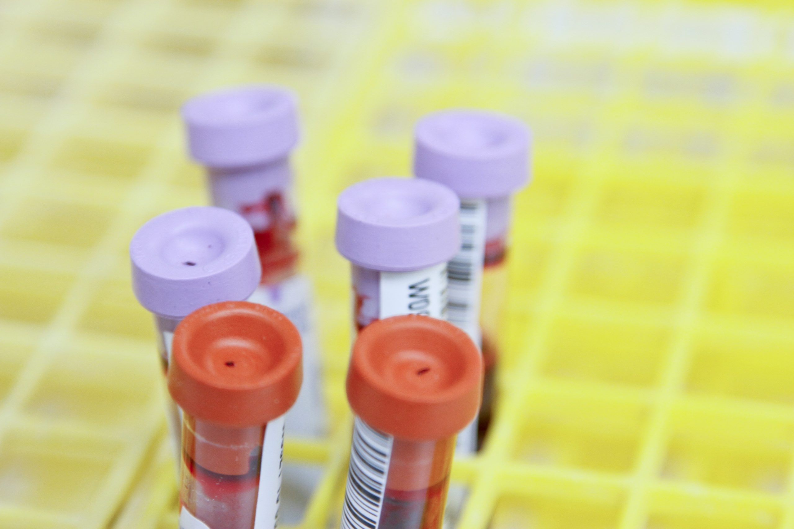 Tubes-laboratoires