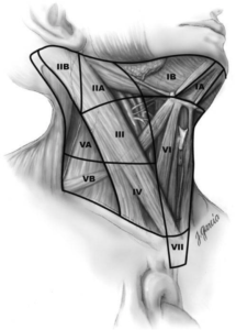 Secteurs ganglionnaires cervicaux : anatomie, classification de Robbins et types de curage — guide pour le cancer thyroïdien